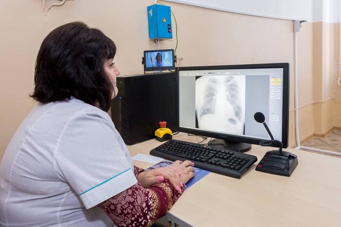 В последние 2 года в Приднестровье снизилась заболеваемость туберкулёзом