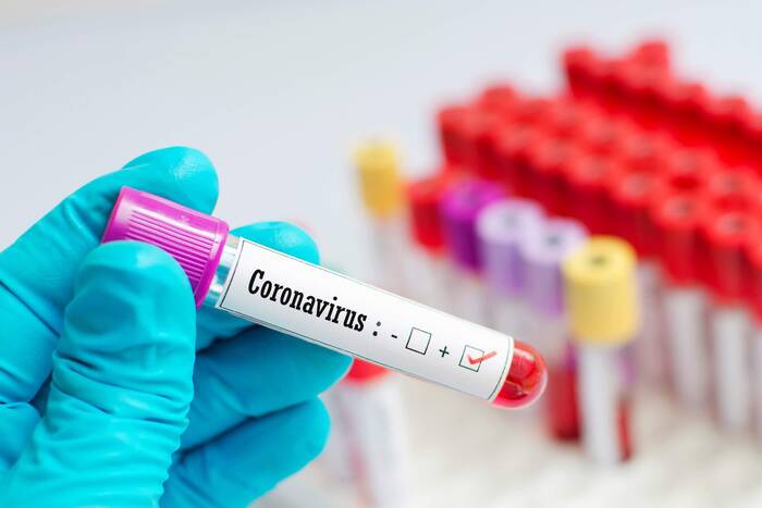 За минувшую неделю коронавирусом заразились 1 420 приднестровцев – Оперштаб при Президенте 